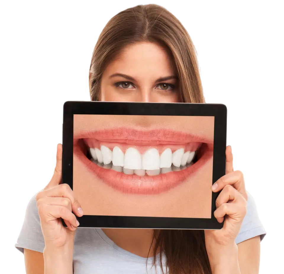 Digital Smile Design