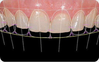 Digital Smile Design