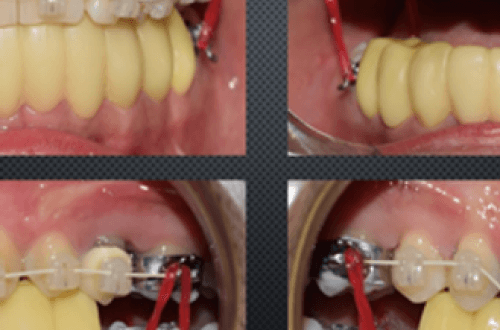 Neuromuscular-Orthodontics