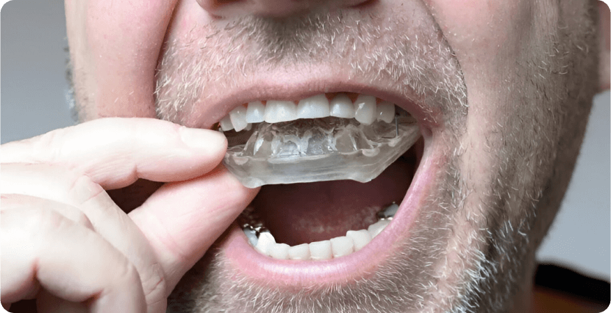 causes of jaw locking