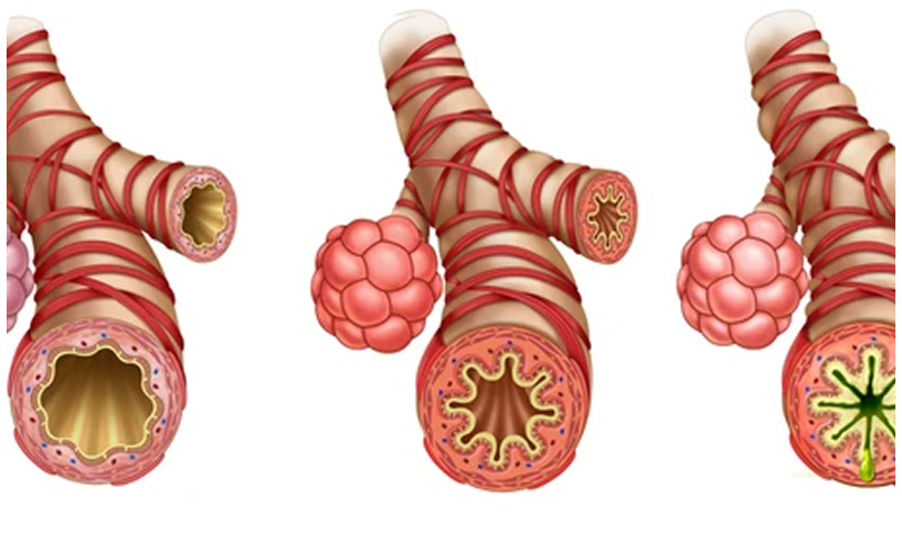 Common Causes of Sleep Apnea