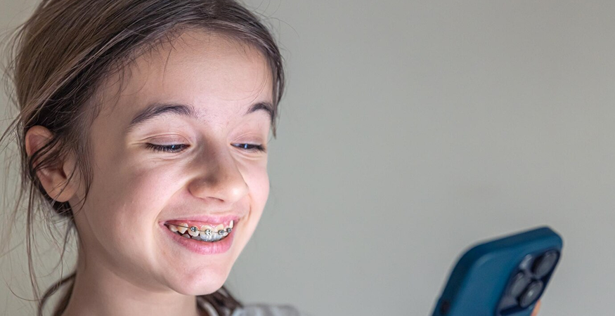 options for shortest time period for braces