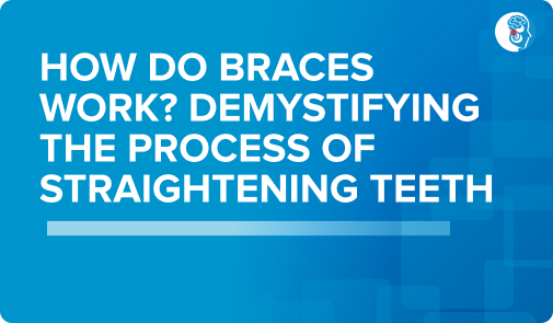 how-do-braces-work