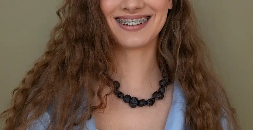 How Do Braces Work_ Demystifying the Process of Straightening Teeth