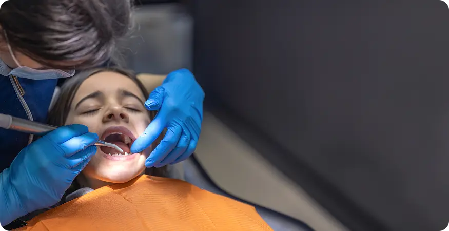 Professional Tartar Removal