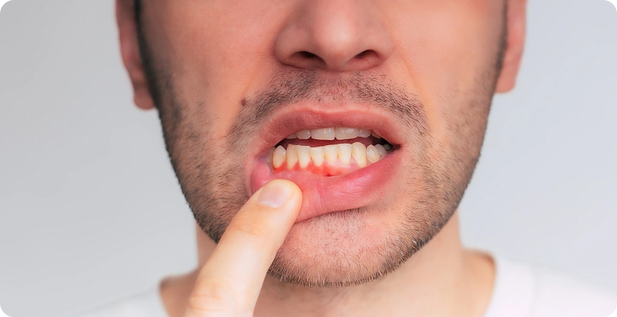 Signs That You Need Immediate Dental Attention